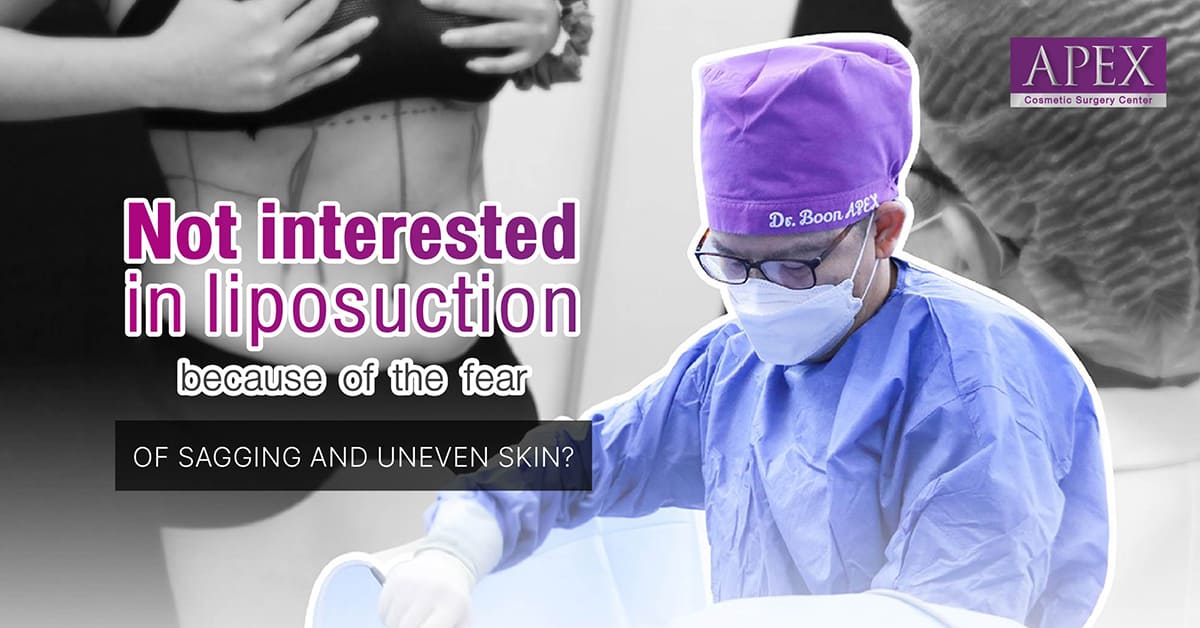 Overcome Concerns of Sagging Skin: Embrace Liposuction for Smoother Results