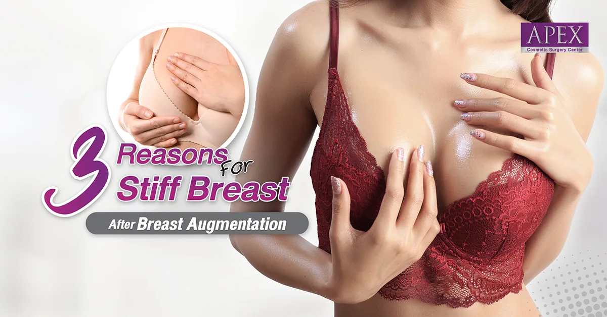 3 Reasons for Stiff Breast After Breast Augmentation