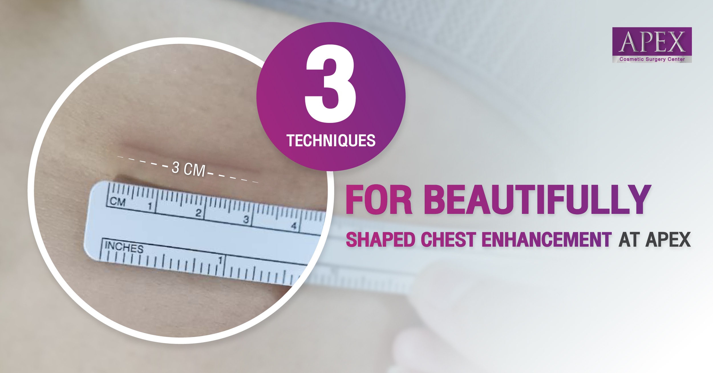 3 Techniques for Beautifully Shaped Chest Enhancement at APEX