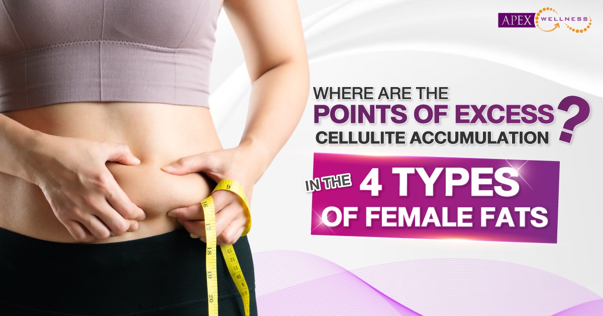 The 4 types of fat in women, which areas are the sources of excess cellulite accumulation?