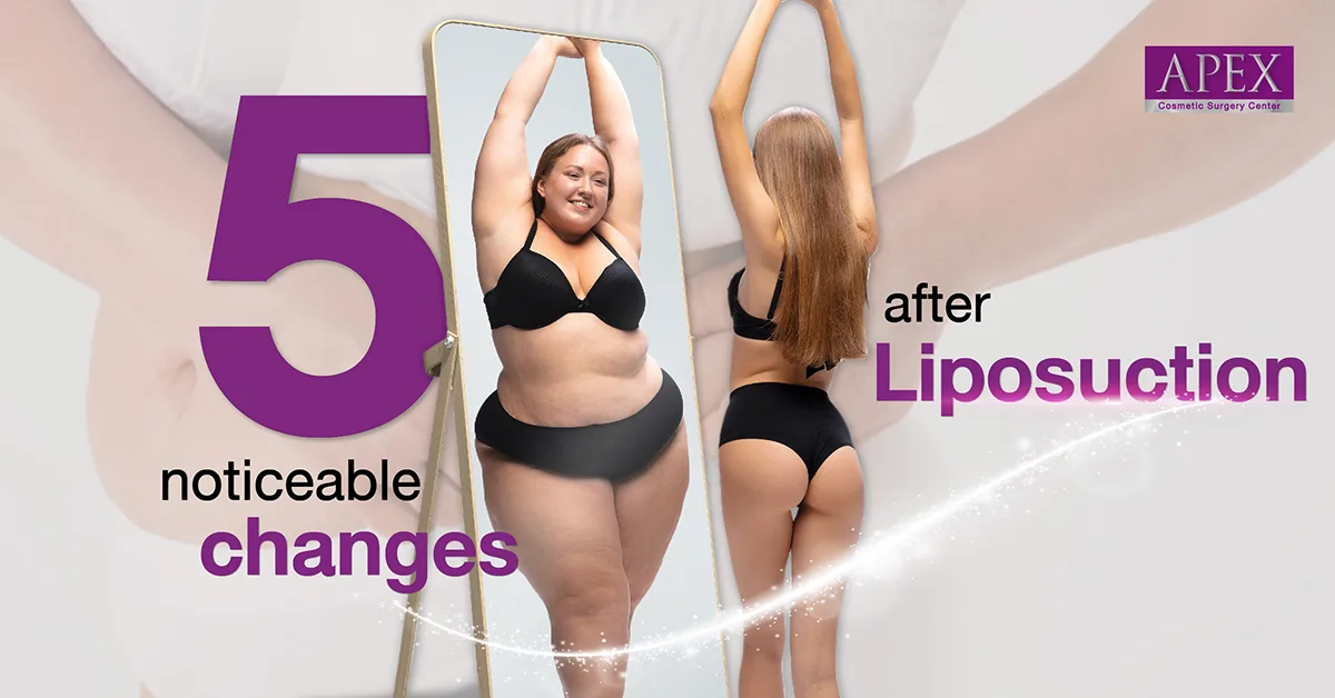 5 noticeable changes after liposuction surgery