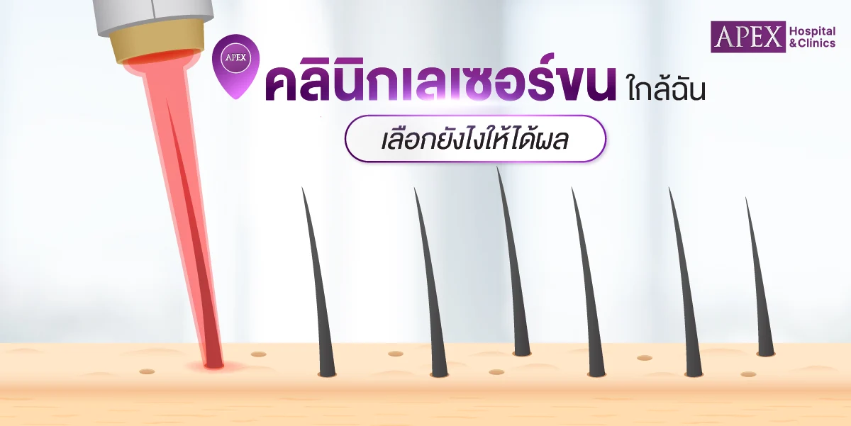 คลินิกเลเซอร์ขนใกล้ฉัน เลือกยังไงให้ได้ผลผิวเนียน