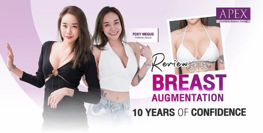 Breast Augmentation Journey: 10 Years of Confidence