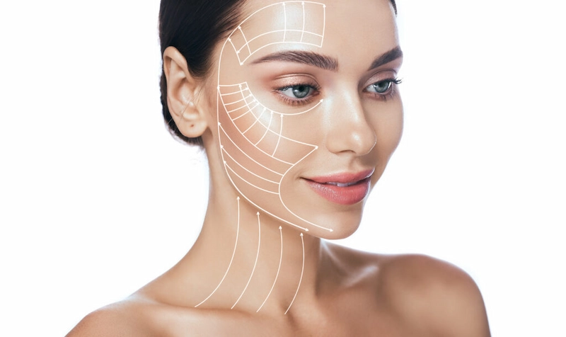 Face and Neck Lift