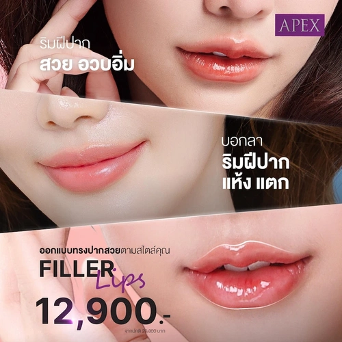 ออกแบบทรงปากสวยตามสไตล์คุณ ฉีดฟิลเลอร์ปาก ราคา 12900 บาท