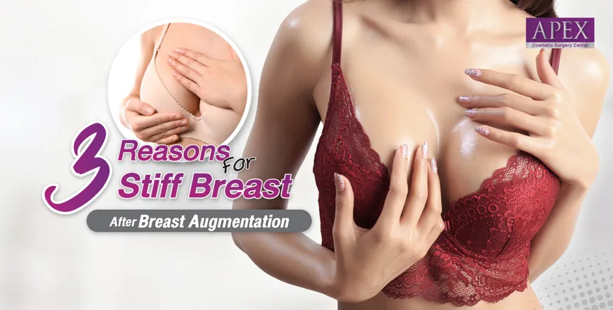 3 Reasons for Stiff Breast After Breast Augmentation