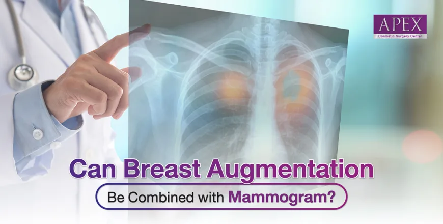 Can Breast Augmentation Be Combined with Mammogram