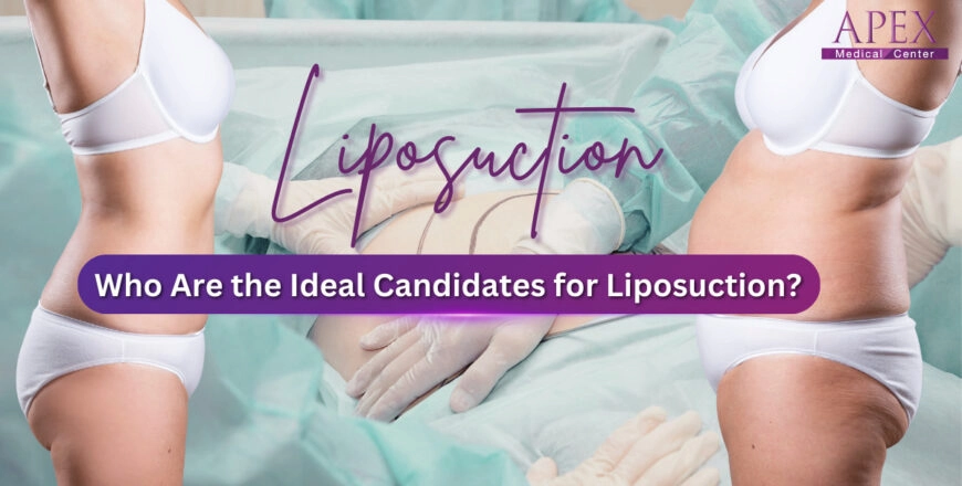 Who Are the Ideal Candidates for Liposuction?